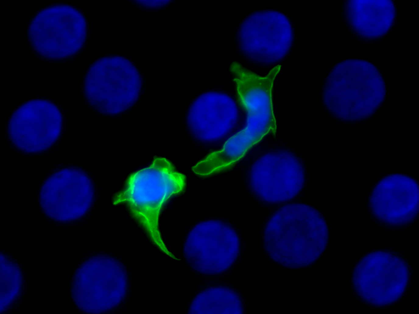 Каква е целта на Théa Open Innovation?